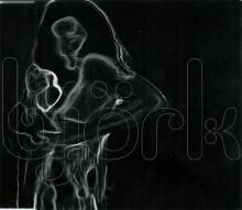 Aurora (Opiate version) Aurora (Opiate version) cover picture